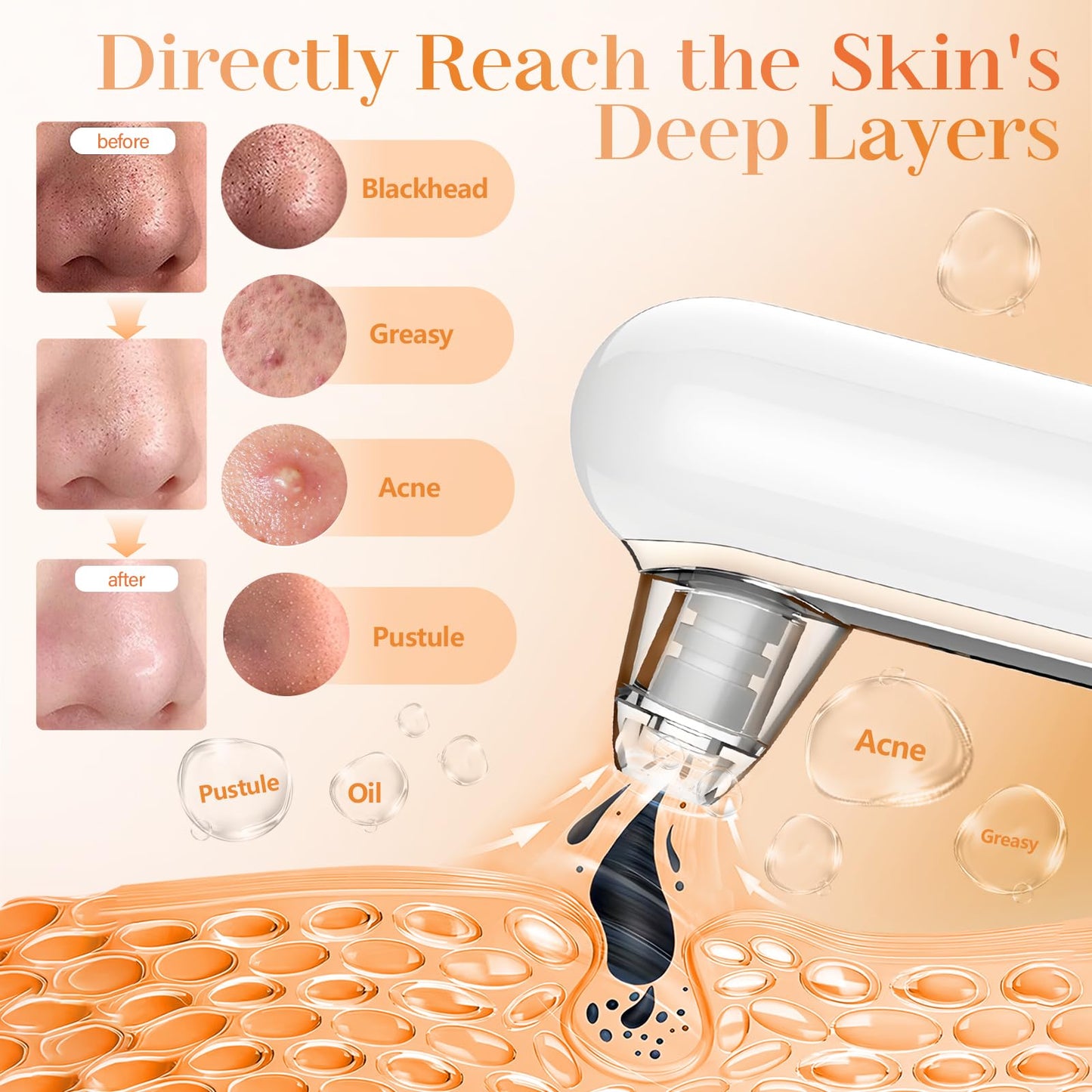 LIMPIADOR DE POROS ELÉCTRICO