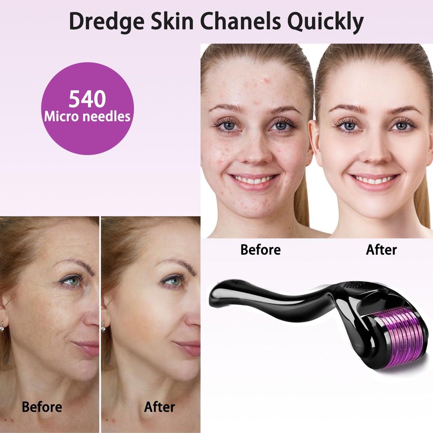 RODILLO PARA PROMOVER EL CRECIMIENTO DEL CABELLO